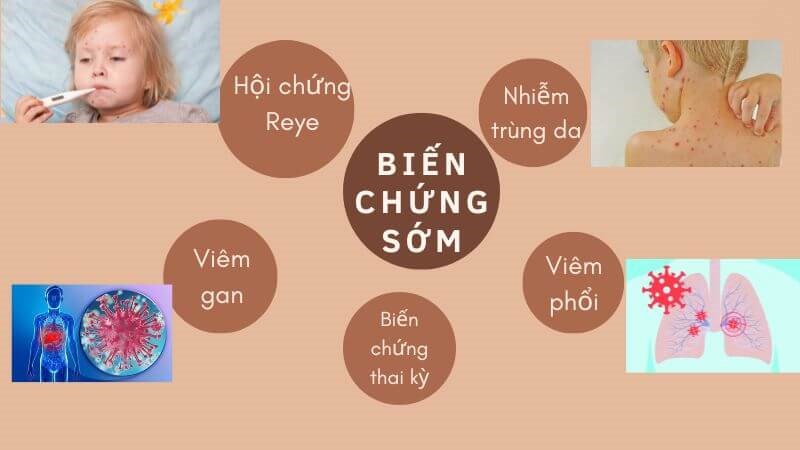 Biến chứng sớm của thuỷ đậu