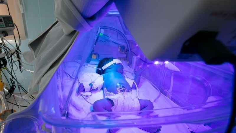 Cân nặng của trẻ sơ sinh có thể báo hiệu một số vấn đề về sức khỏe của bé Cân nặng của trẻ sơ sinh có thể báo hiệu một số vấn đề về sức khỏe của bé