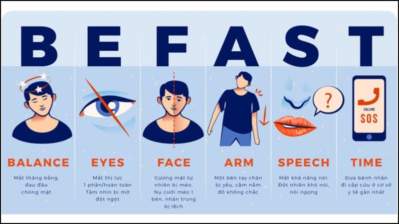 Khi có bất kỳ dấu hiệu nào của đột quỵ, bạn nên gấp rút đi khám bác sĩ hoặc gọi cấp cứu ngay lập tức Khi có bất kỳ dấu hiệu nào của đột quỵ, bạn nên gấp rút đi khám bác sĩ hoặc gọi cấp cứu ngay lập tức