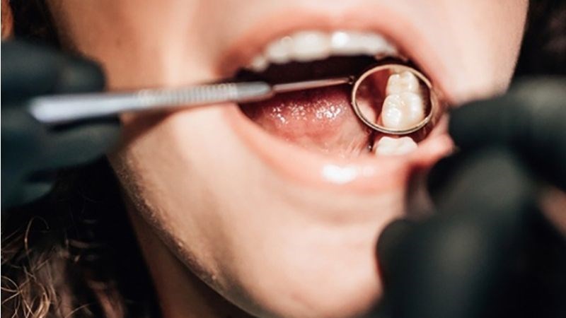 Sử dụng răng sau để nhai giúp ngăn ngừa thức ăn mắc kẹt trong mắc cài 