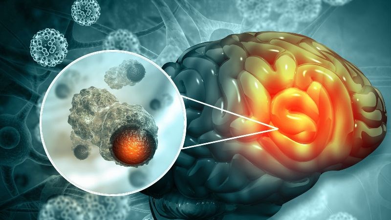 Khối u ác tính không thể điều trị khỏi hoàn toàn