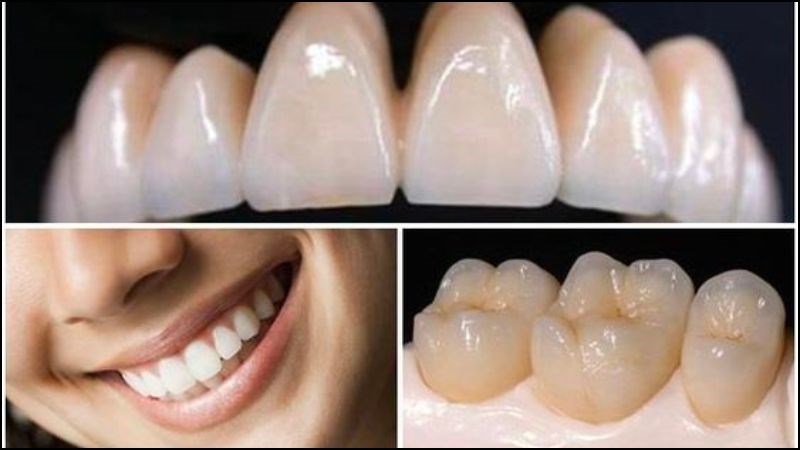 Phòng ngừa và chăm sóc răng thường xuyên để răng luôn trắng khoẻ Phòng ngừa và chăm sóc răng thường xuyên để răng luôn trắng khoẻ