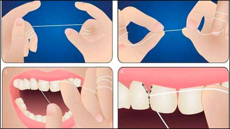 Dùng chỉ nha khoa và đánh răng thường xuyên để răng chắc khoẻ Dùng chỉ nha khoa và đánh răng thường xuyên để răng chắc khoẻ
