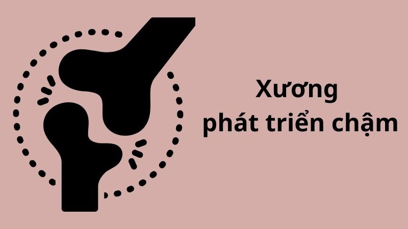 Xương dài ra chậm có thể tăng nguy cơ nhiễm trùng