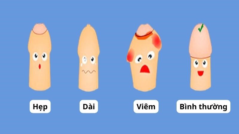 Đau khi quan hệ ở nam thường đến từ nguyên nhân tại dương vật