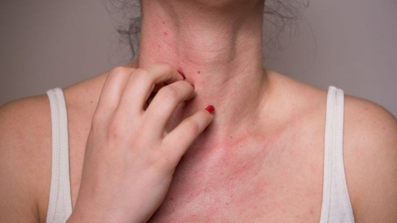 Mật ong sẽ không thích hợp với người có cơ địa dễ bị dị ứng Mật ong sẽ không thích hợp với người có cơ địa dễ bị dị ứng