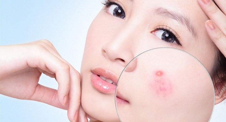 Da mụn vẫn có thể sử dụng máy massage mặt để hỗ trợ làm sạch da, đem lại một làn da khỏe mạnh