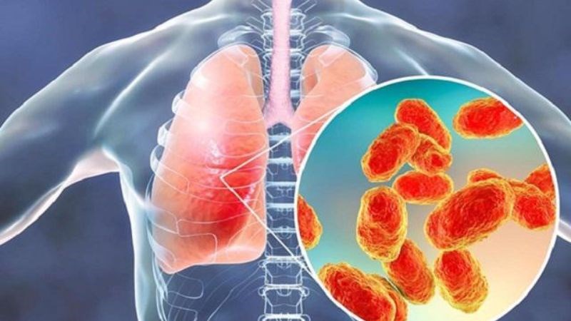 Ho do viêm phổi là một trong những nguyên nhân thường gặp