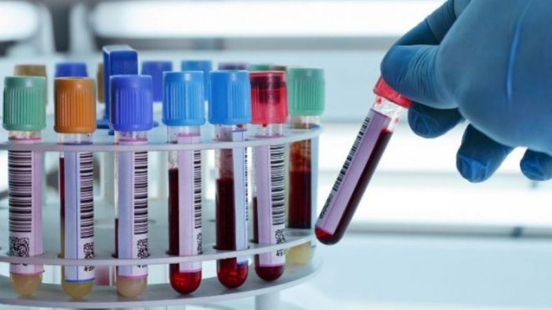 Bạn nên ngừng bổ sung biotin trước khi xét nghiệm máu 3 ngày