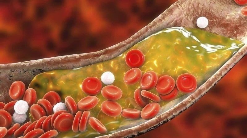 Vitamin B3 có tác dụng hỗ trợ cải thiện cholesterol máu