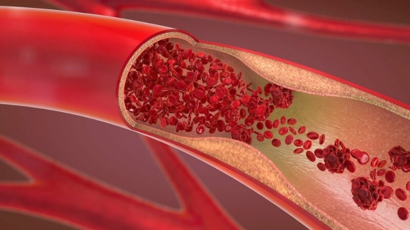 Vitamin C làm giảm tác dụng chống đông máu của warfarin