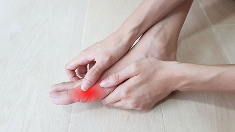 Vitamin C làm giảm các cơn đau do bệnh Gút