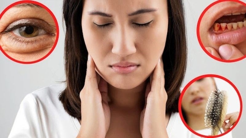 Thiếu vitamin C có thể gây ra bệnh Scorbut