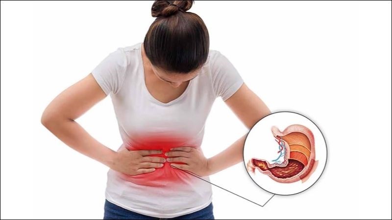 Người có tiền sử bệnh dạ dày nên hỏi ý kiến bác sĩ trước khi bổ sung vitamin C