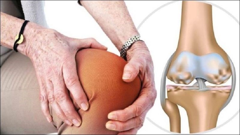 Thiếu hụt vitamin C kéo dài có thể dẫn đến thoái hoá khớp