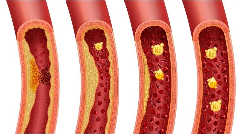 Vitamin K2 là gì? Công dụng, liều dùng và tác dụng phụ khi sử dụng