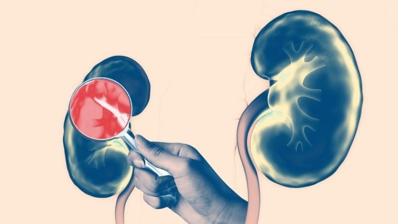 Khi cơ thể có quá nhiều vitamin D có thể gây tổn thương thận