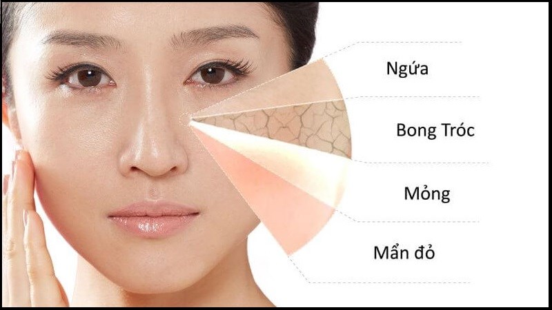 Bỏng retinol là gì? Nguyên nhân, điều trị và cách phòng ngừa