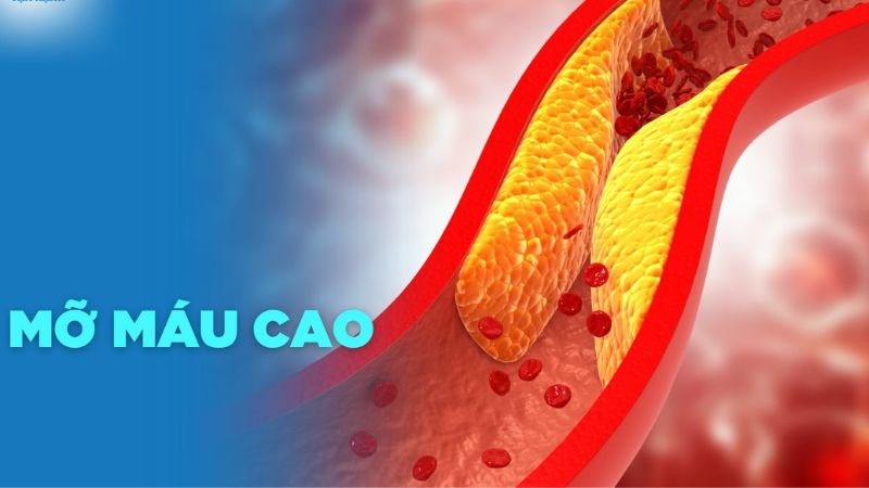 L-arginine không có tác dụng làm giảm nồng độ cholesterol trong máu