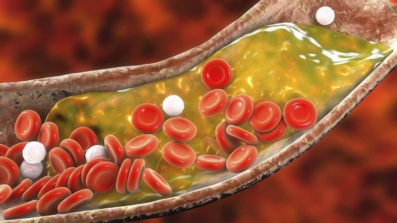 Beta Glucan có tác dụng ngăn chặn sự hấp thu cholesterol vào máu Beta Glucan có tác dụng ngăn chặn sự hấp thu cholesterol vào máu