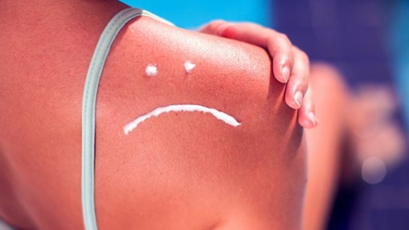 Cháy nắng là tác hại phổ biến nhất khi tiếp xúc quá nhiều với ánh nắng mặt trời