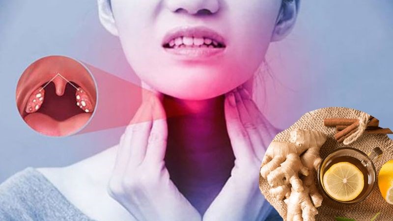 Gừng có chứa các hoạt tính chống viêm giúp trừ ho
