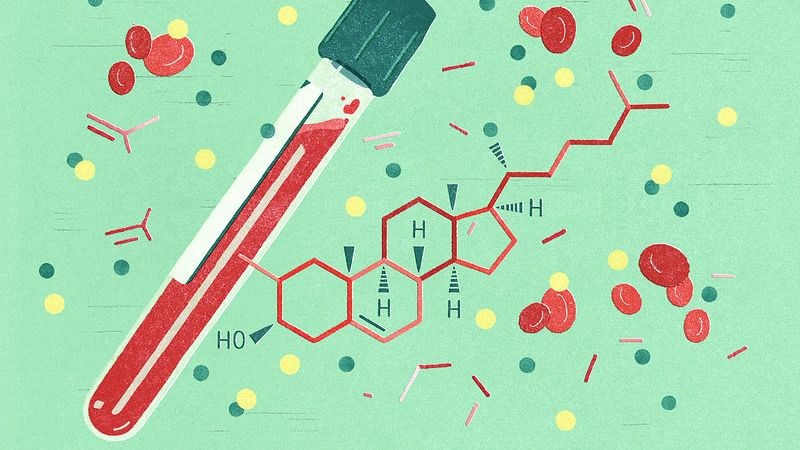Xét nghiệm máu có thể giúp xác định được nồng độ LDL và HDL cholesterol