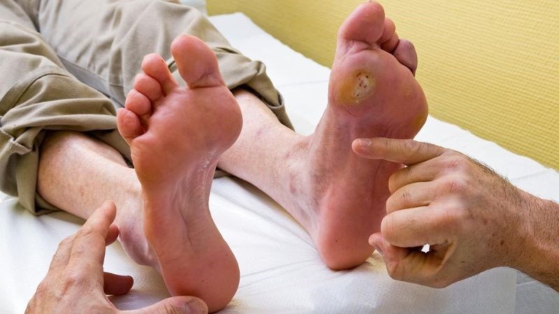 Nồng độ glucose cao sẽ tạo điều kiện thuận lợi cho sự phát triển của nấm và vi khuẩn