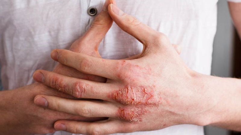 Mức đường huyết cao có thể làm chậm quá trình tái tạo tế bào mới