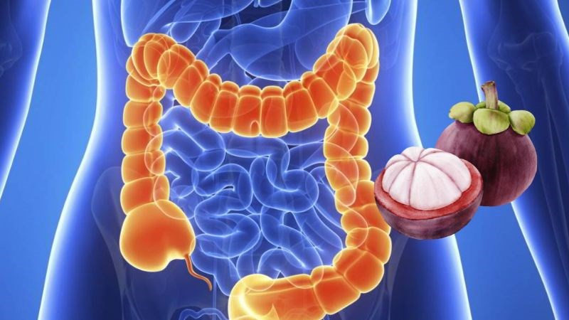 Hợp chất xanthones trong măng cụt giúp phòng ngừa ung thư ruột kết