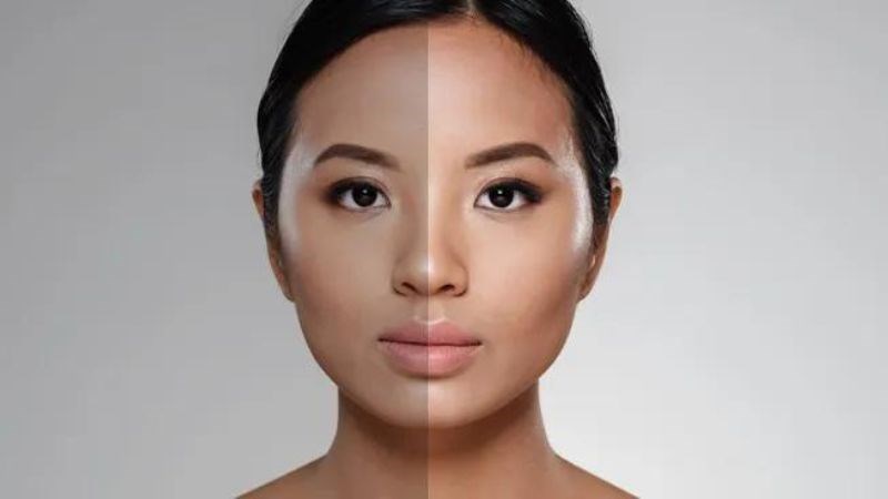 Tyrosine hỗ trợ tổng hợp sắc tố melanin của da