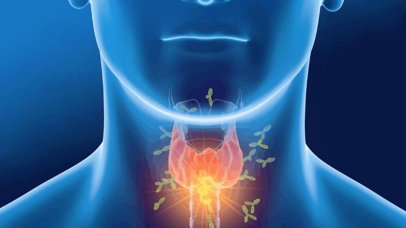 Bệnh nhân cường giáp không nên bổ sung tyrosine