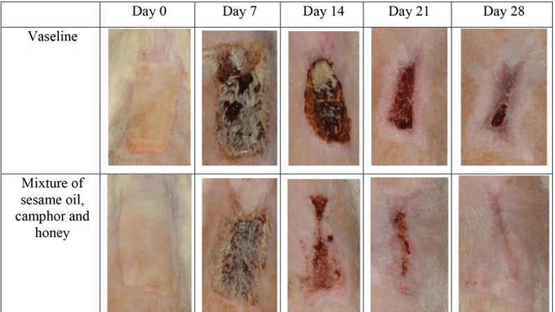 Long não giúp điều trị bỏng