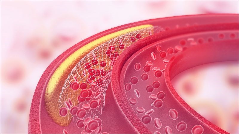 Yến mạch giúp giảm mức cholesterol xấu trong cơ thể rất hiệu quả