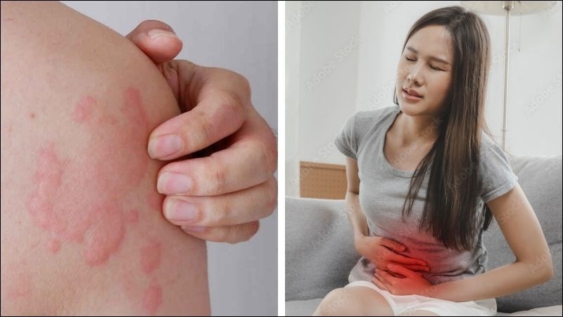 Sử dụng lạc tiên có thể gây ra một số tác dụng phụ như dị ứng hoặc rối loạn tiêu hóa