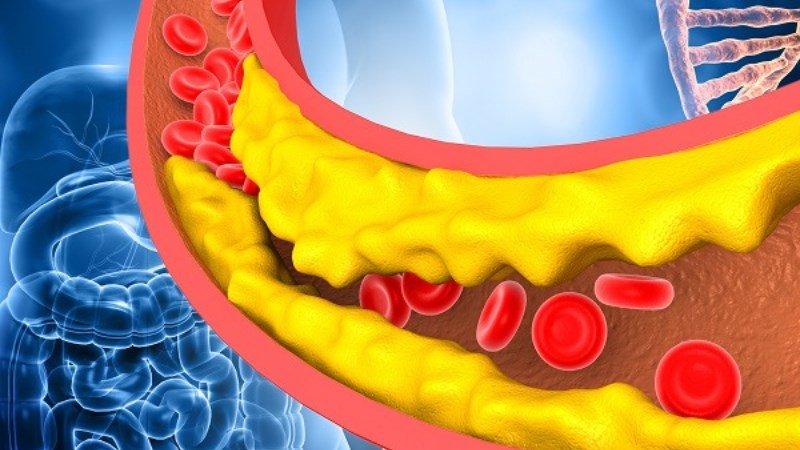 Nhân sâm có thể giúp cải thiện tình trạng dư thừa cholesterol trong cơ thể