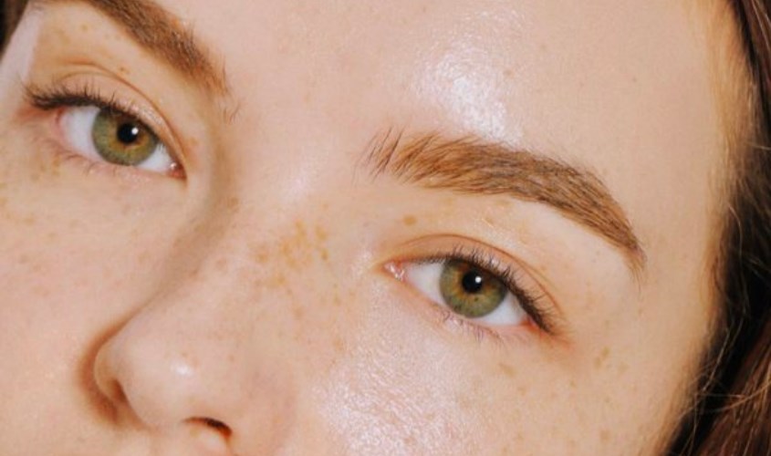 Kem đánh răng có thể dùng trị nám nhẹ