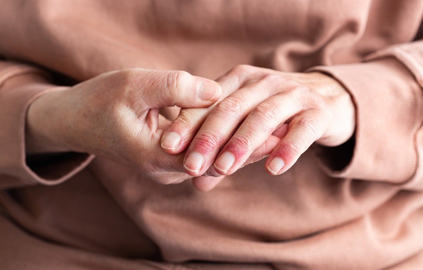 Lưu ý khi sử dụng dầu mù u để tránh Lưu ý khi sử dụng dầu mù u để tránh