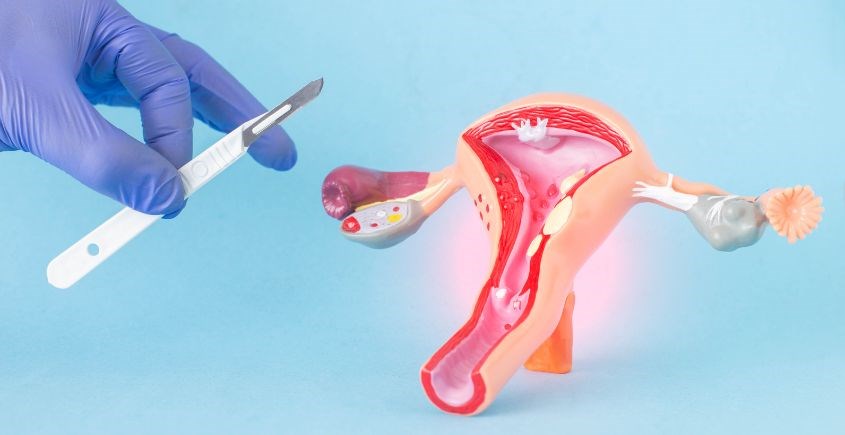 Quan hệ không dùng bao cao su dẫn đến viêm nhiễm phụ khoa ở nữ