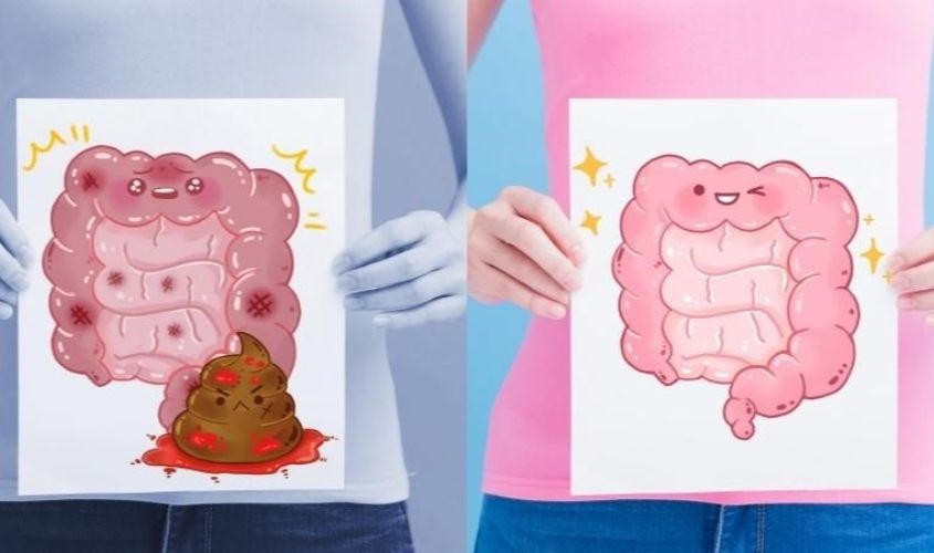 Chất xơ phòng ngừa tình trạng táo bón Chất xơ phòng ngừa tình trạng táo bón