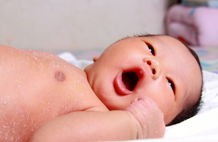 Bong tróc da là hiện tượng phổ biến ở trẻ sơ sinh