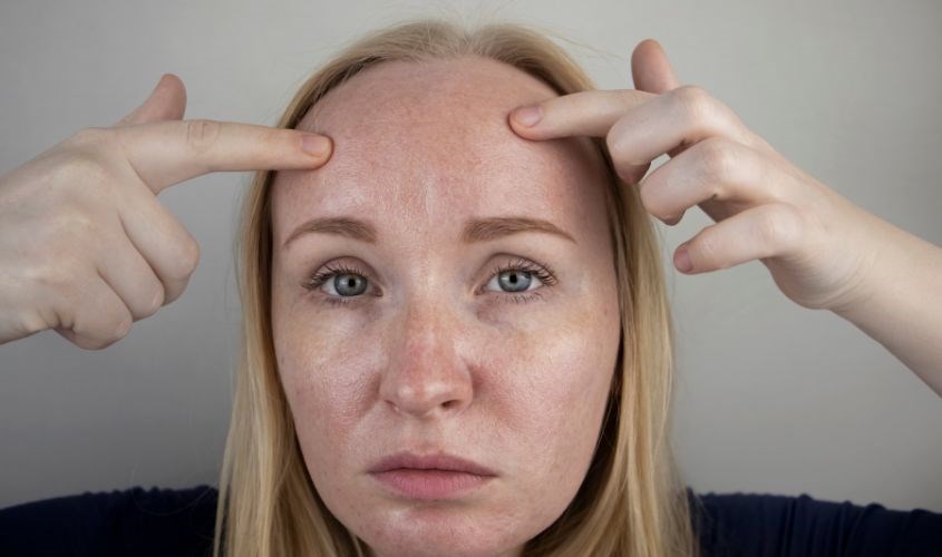 Kem chống nắng vật lý dễ gây tối và sạm màu da