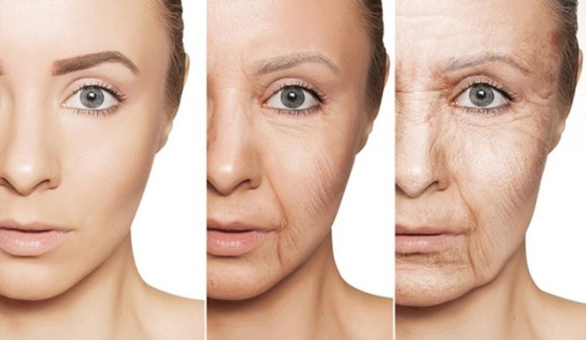 Da xuất hiện nhiều nếp nhăn 