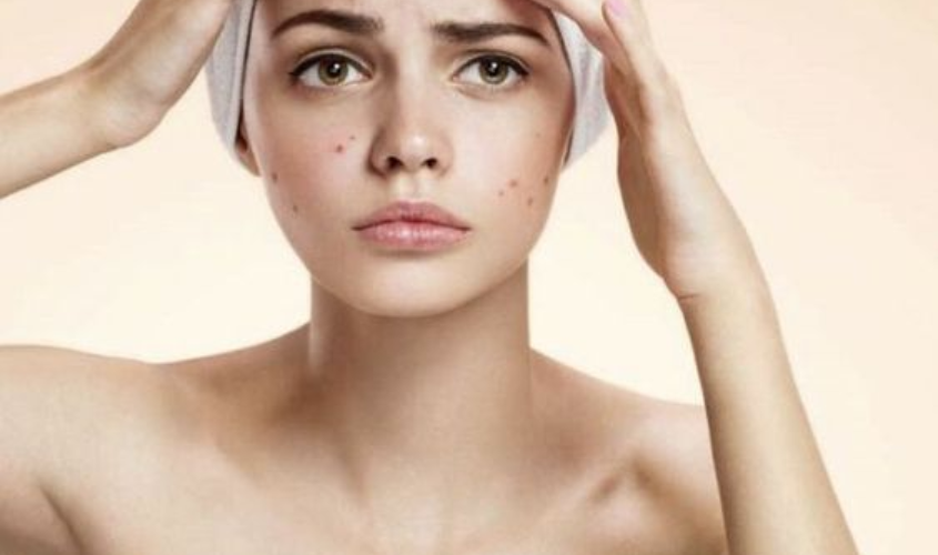 Cọ trang điểm bẩn gây kích ứng, nổi mụn trên da