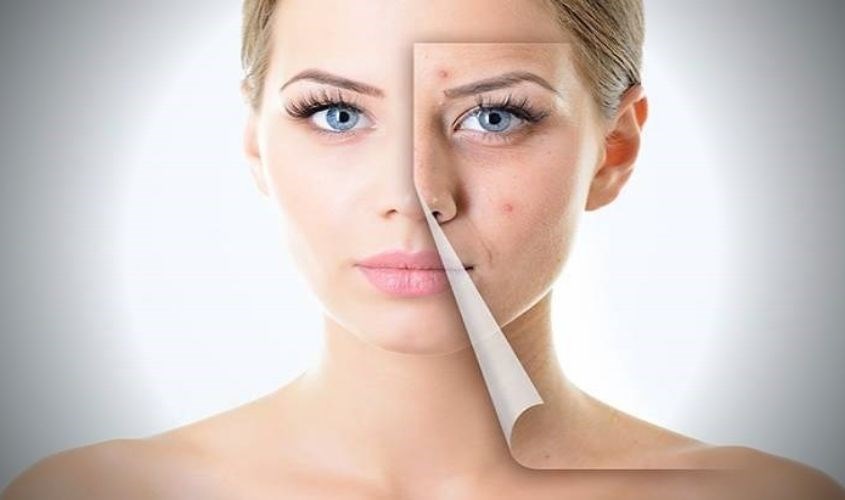 Nước muối hột, iot pha loãng hay nước muối sinh lý đều đem lại hiệu quả như nhau khi rửa mặt