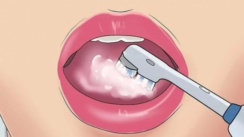 Bước 5: Làm sạch bề mặt lưỡi và vòm miệng