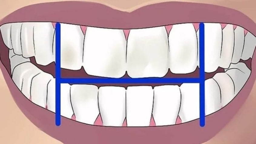 Bước 2: Chia miệng của bạn thành bốn góc