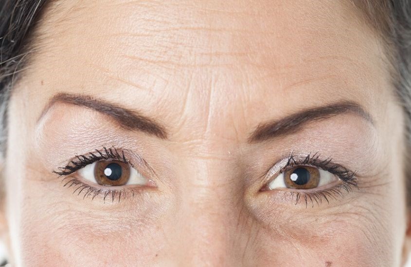 Ngăn ngừa lão hóa, giảm nếp nhăn Ngăn ngừa lão hóa, giảm nếp nhăn