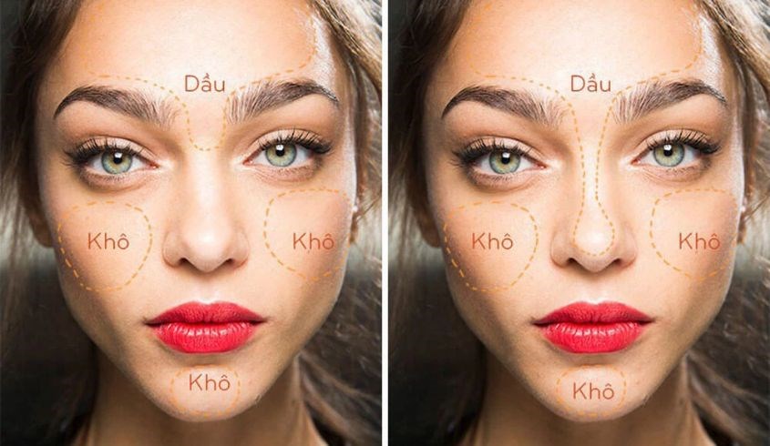 Da thiên dầu và da thiên khô có một số đặc điểm khác nhau