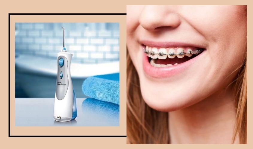 Máy tăm nước Waterpik Cordless Plus WP-450 thích hợp cho người niềng răng
